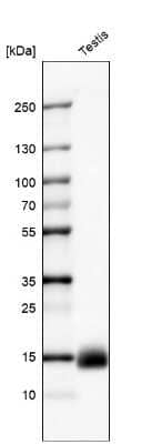 Western Blot: CTAG1B Antibody (CL10130) [NBP2-88943] - Analysis in human testis tissue.