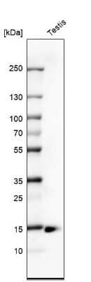 Western Blot: CTAG1B Antibody (CL10165) [NBP2-88944] - Analysis in human testis tissue.