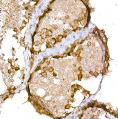 Immunohistochemistry-Paraffin: CTAG1B Antibody [NBP2-92840] -  Human testis using NY-ESO-1 Rabbit pAb at dilution of 1:150 (40x lens).Perform high pressure antigen retrieval with 10 mM Tris/EDTA buffer pH 8.0 before commencing with IHC staining protocol.