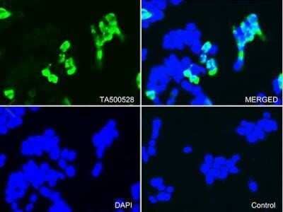 Immunocytochemistry/Immunofluorescence: CTAG1B Antibody (OTI2B6) - Azide and BSA Free [NBP2-70485] - Staining of 293T cells transfected by pCMV6-ENTRY CTAG1B(RC213318) using anti-CTAG1B antibody (green, upper left; DAPI/blue, lower left; merged, upper right). 293T cells transfected with empty vector served as a negative control (merged, lower right). (1: