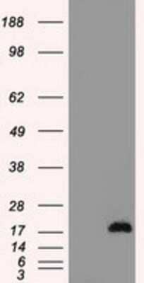 Western Blot: CTAG1B Antibody (OTI2B6) - Azide and BSA Free [NBP2-70485] - HEK293T cells were transfected with the pCMV6-ENTRY control (Left lane) or pCMV6-ENTRY CTAG1B (Right lane) cDNA for 48 hrs and lysed. Equivalent amounts of cell lysates (5 ug per lane) were separated by SDS-PAGE and immunoblotted with anti-CTAG1B.