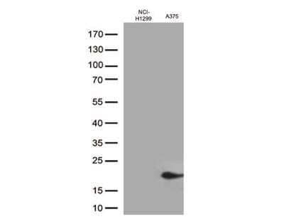 Western Blot: CTAG1B Antibody (OTI2B6) - Azide and BSA Free [NBP2-70485] - Analysis of extracts (35ug) from 2 cell lines lysates by using anti-CTAG1B monoclonal antibody (1:500).