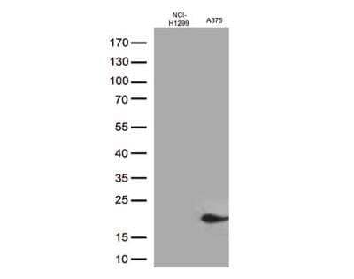 Western Blot: CTAG1B Antibody (OTI2B6) [NBP1-47714] - Western blot analysis of extracts (35ug) from 2 cell lines lysates by using anti-CTAG1B monoclonal antibody (1:500).