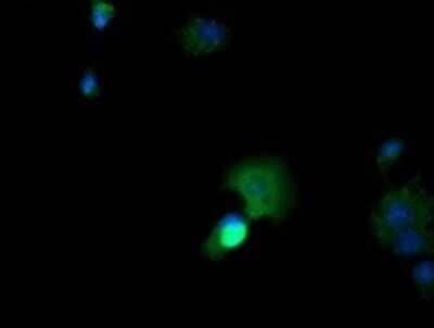 Immunocytochemistry/Immunofluorescence: CTAG1B Antibody (OTI5H4) - Azide and BSA Free [NBP2-70486] - Analysis  of COS7 cells transiently transfected by pCMV6-ENTRY CTAG1B.