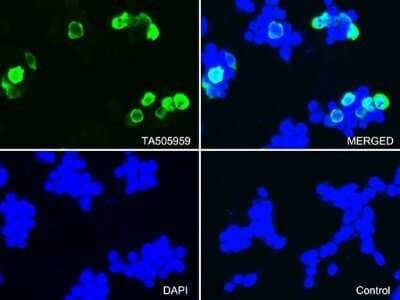 Immunocytochemistry/Immunofluorescence: CTAG1B Antibody (OTI5H4) - Azide and BSA Free [NBP2-70486] - Staining of 293T cells transfected by pCMV6-ENTRY CTAG1B .