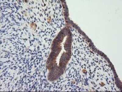 Immunohistochemistry: CTAG1B Antibody (OTI5H4) - Azide and BSA Free [NBP2-70486] - Analysis of Human endometrium tissue . (Heat-induced epitope retrieval by 10mM citric buffer, pH6.0, 120C for 3min)