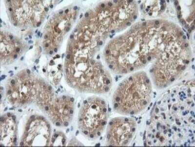 Immunohistochemistry: CTAG1B Antibody (OTI5H4) - Azide and BSA Free [NBP2-70486] - Analysis of Human Kidney tissue. (Heat-induced epitope retrieval by 10mM citric buffer, pH6.0, 120C for 3min)