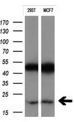 Western Blot: CTAG1B Antibody (OTI5H4) - Azide and BSA Free [NBP2-70486] - Analysis of extracts (10ug) from 293T and MCF7 cell lines.