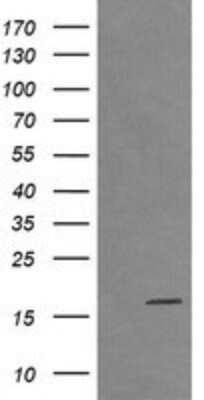 Western Blot: CTAG1B Antibody (OTI5H4) - Azide and BSA Free [NBP2-70486] - Analysis of HEK293T cells were transfected with the pCMV6-ENTRY control (Left lane) or pCMV6-ENTRY CTAG1B.