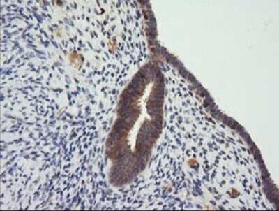 Immunohistochemistry: CTAG1B Antibody (OTI5H4) [NBP2-46386] - Analysis of Human endometrium tissue . (Heat-induced epitope retrieval by 10mM citric buffer, pH6.0, 120C for 3min)