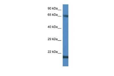 Western Blot: CTAG1B Antibody [NBP2-88796] - WB Suggested Anti-CTAG1B Antibody. Titration: 1.0 ug/ml. Positive Control: Jurkat Whole Cell