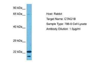 Western Blot: CTAG1B Antibody [NBP2-88796] - Host: Rabbit. Target Name: CTAG1B. Sample Tissue: Human 786-0 Whole Cell. Antibody Dilution: 1ug/ml