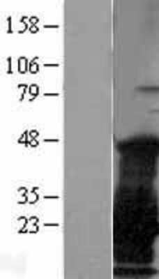 Western Blot: CTAG1B Overexpression Lysate (Adult Normal) [NBL1-09562] Left-Empty vector transfected control cell lysate (HEK293 cell lysate); Right -Over-expression Lysate for CTAG1B.