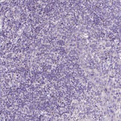 Immunohistochemistry-Paraffin: CTAG2 Antibody [NBP2-49659] - Staining of human tonsil shows no positivity in non-germinal center cells as expected.