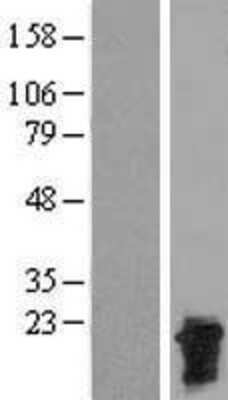 Western Blot: CTAG2 Overexpression Lysate (Adult Normal) [NBP2-05158] Left-Empty vector transfected control cell lysate (HEK293 cell lysate); Right -Over-expression Lysate for CTAG2.