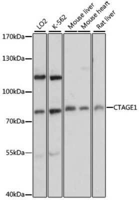 Western Blot CTAGE1 Antibody - Azide and BSA Free