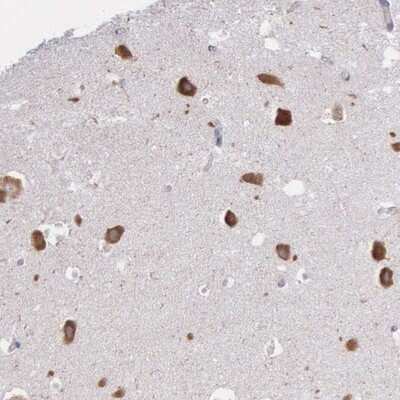 Immunohistochemistry-Paraffin: CTAGE5 Antibody [NBP1-85390] - Staining of human hippocampus shows strong cytoplasmic positivity in neuronal cells.