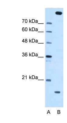 Western Blot: CTAGE5 Antibody [NBP1-62218] - HepG2 cell lysate, concentration 0.2-1 ug/ml.