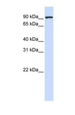 Western Blot: CTAGE5 Antibody [NBP1-69250] - This Anti-CTAGE5 antibody was used in Western Blot of 293T tissue lysate at a concentration of 1ug/ml.