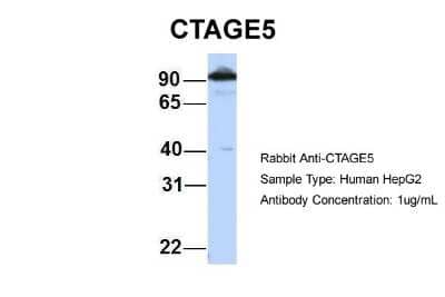 Western Blot: CTAGE5 Antibody [NBP1-69250] - Analysis of HepG2 cell lysate. Antibody Dilution: 1.0 ug/ml CTAGE5 is strongly supported by BioGPS gene expression data to be expressed in Human HepG2 cells.