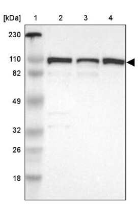 Western Blot CTAGE5 Antibody