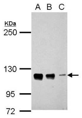 Western Blot CTAGE5 Antibody