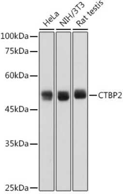 Western Blot: CTBP2 Antibody (1R1U6) [NBP3-15268] - Analysis of extracts of various cell lines, using CTBP2 antibody (NBP3-15268) at 1:1000 dilution. Secondary antibody: HRP Goat Anti-Rabbit IgG (H+L) at 1:10000 dilution. Lysates/proteins: 25ug per lane. Blocking buffer: 3% nonfat dry milk in TBST. Detection: ECL Basic Kit. Exposure time: 1s.