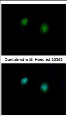 Immunocytochemistry/Immunofluorescence: CTBP2 Antibody [NBP2-16024] - Immunofluorescence analysis of methanol-fixed HeLa, using antibody at 1:500 dilution.