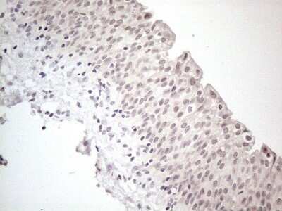 Immunohistochemistry: CTBP2 Antibody (OTI4D4) - Azide and BSA Free [NBP2-70487] - Analysis of Human bladder tissue. (Heat-induced epitope retrieval by 1mM EDTA in 10mM Tris buffer (pH8.5) at 120C for 3 min)