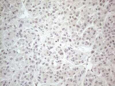 Immunohistochemistry: CTBP2 Antibody (OTI4D4) - Azide and BSA Free [NBP2-70487] - Analysis of Human liver tissue. (Heat-induced epitope retrieval by 1mM EDTA in 10mM Tris buffer (pH8.5) at 120C for 3 min)