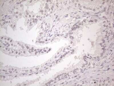 Immunohistochemistry: CTBP2 Antibody (OTI4D4) - Azide and BSA Free [NBP2-70487] - Analysis of Human prostate tissue. (Heat-induced epitope retrieval by 1mM EDTA in 10mM Tris buffer (pH8.5) at 120C for 3 min)