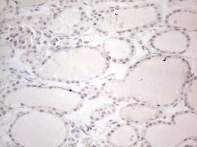 Immunohistochemistry: CTBP2 Antibody (OTI4D4) - Azide and BSA Free [NBP2-70487] - Analysis of Human thyroid tissue. (Heat-induced epitope retrieval by 1mM EDTA in 10mM Tris buffer (pH8.5) at 120C for 3 min)