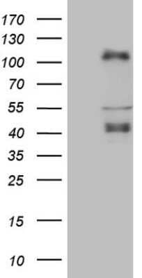 Western Blot: CTBP2 Antibody (OTI4D4) - Azide and BSA Free [NBP2-70487] - Analysis of HEK293T cells were transfected with the pCMV6-ENTRY control (Left lane) or pCMV6-ENTRY CTBP2.