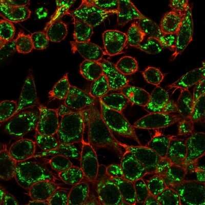 Immunocytochemistry/Immunofluorescence: CTBP2 Antibody (PCRP-CTBP2-1A9) - C-terminus - Azide and BSA Free [NBP3-08549] - Immunofluorescence Analysis of HeLa cells using CTBP2 Mouse Monoclonal Antibody (PCRP-CTBP2-1A9) followed by goat anti- Mouse IgG-CF488 (green). CF640A phalloidin (red).