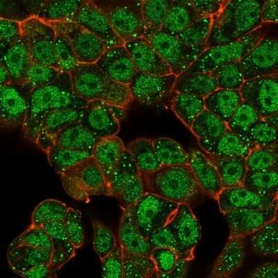 Immunocytochemistry/Immunofluorescence: CTBP2 Antibody (PCRP-CTBP2-2D11) - C-terminus - Azide and BSA Free [NBP3-08550] - Immunofluorescence Analysis of MCF-7 cells using CTBP2 Mouse Monoclonal Antibody (PCRP-CTBP2-2D11) followed by goat anti- Mouse IgG-CF488 (green). Phalloidin (red).
