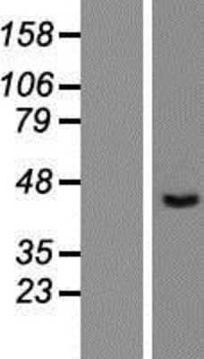 Western Blot: CTBS Overexpression Lysate (Adult Normal) [NBP2-07876] Left-Empty vector transfected control cell lysate (HEK293 cell lysate); Right -Over-expression Lysate for CTBS.