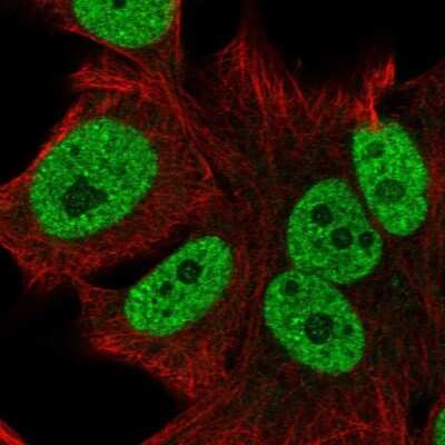 Immunocytochemistry/Immunofluorescence: CTC-534A2.2 Antibody [NBP2-49564] - Staining of human cell line SK-MEL-30 shows localization to nucleoplasm. Antibody staining is shown in green. 