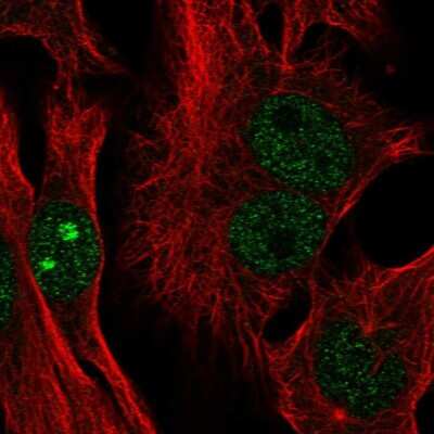 Immunocytochemistry/Immunofluorescence: CTC-534A2.2 Antibody [NBP2-57715] - Staining of human cell line SK-MEL-30 shows localization to nucleus & nucleoli. Antibody staining is shown in green.