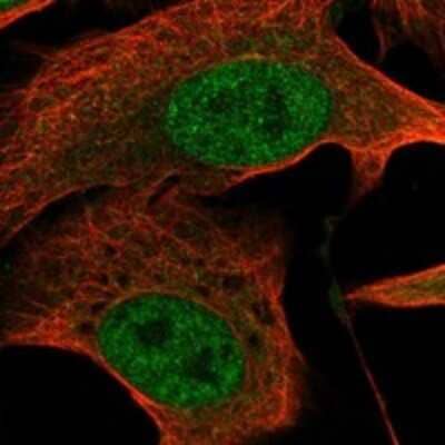 Immunocytochemistry/ Immunofluorescence CTC1 Antibody