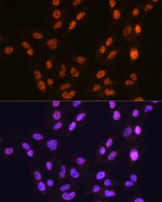 Immunocytochemistry/Immunofluorescence: CTCF Antibody (4W9B0) [NBP3-15795] - Immunofluorescence analysis of C6 cells using CTCF antibody (NBP3-15795). Blue: DAPI for nuclear staining.