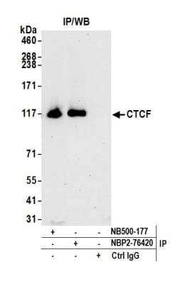 <b>Independent Antibodies Validation. </b>Immunoprecipitation: CTCF Antibody (BLR041F) [NBP2-76420] - Detection of human CTCF by WB of immunoprecipitates from HEK293T lysate. Antibodies: Rabbit anti-CTCF recombinant monoclonal [BLR041F] (NBP2-76420) and rabbit anti-CTCF (NB500-177).