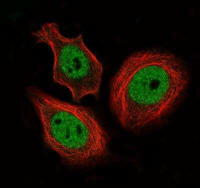 <b>Genetic Strategies Validation. </b>Immunocytochemistry/Immunofluorescence: CTCF Antibody (CL0304) [NBP2-52909] - Staining of MCF7 cells using the Anti-CTCF monoclonal antibody, showing specific staining in the nucleoplasm in green. Microtubule- and nuclear probes are visualized in red and blue, respectively (where available). Antibody staining is shown in green.