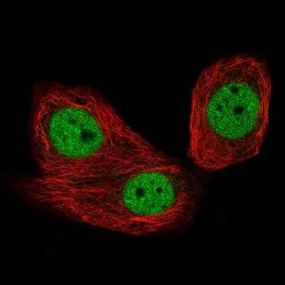 Immunocytochemistry/Immunofluorescence: CTCF Antibody (CL0305) [NBP2-52910] - Staining of MCF7 cells using the Anti-CTCF monoclonal antibody, showing specific staining in the nucleoplasm in green. Microtubule- and nuclear probes are visualized in red and blue, respectively (where available).