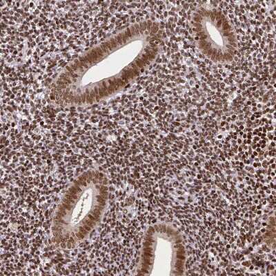 Immunohistochemistry-Paraffin: CTCF Antibody (CL0305) [NBP2-52910] - Staining of human endometrium shows moderate nuclear positivity in glandular and stromal cells.