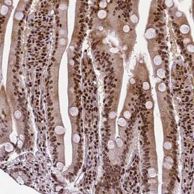 Immunohistochemistry-Paraffin: CTCF Antibody (CL0305) [NBP2-52910] - Staining of human small intestine shows strong nuclear positivity in glandular cells.