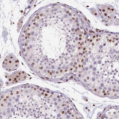 Immunohistochemistry-Paraffin: CTCF Antibody (CL0305) [NBP2-52910] - Staining of human testis shows moderate nuclear positivity in a subset of cells in seminiferous ducts.