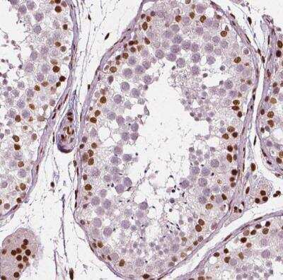 Immunohistochemistry-Paraffin: CTCF Antibody (CL0307) [NBP2-52911] - Staining of human testis shows moderate nuclear positivity in a subset of cells in seminiferous ducts.