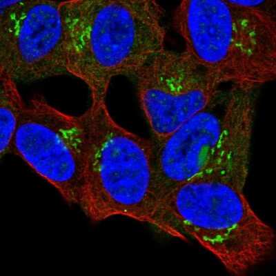 Immunocytochemistry/Immunofluorescence: CTD-3193O13.9 Antibody [NBP2-49372] - Staining of human cell line SH-SY5Y shows localization to nucleus & the Golgi apparatus.