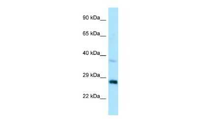 Western Blot: CTDSP1 Antibody [NBP2-87226] - WB Suggested Anti-CTDSP1 Antibody. Titration: 1.0 ug/ml. Positive Control: HepG2 Whole CellCTDSP1 is supported by BioGPS gene expression data to be expressed in HepG2