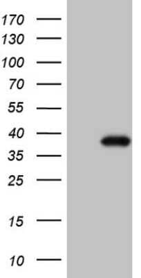 Western Blot CTDSP2 Antibody (OTI7F5)